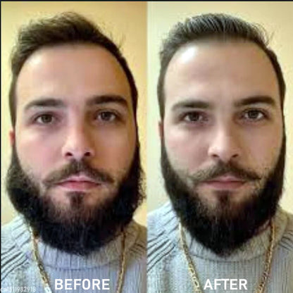 Beard Straightener for Men